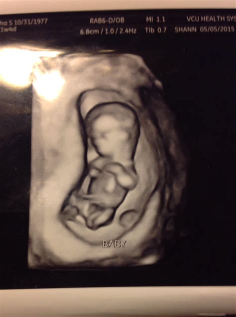 3D Ultrasound at 16 Weeks — The Bump