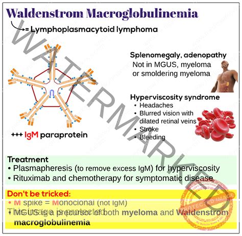 Waldenstrom macroglobulinemia - Medicine Keys for MRCPs