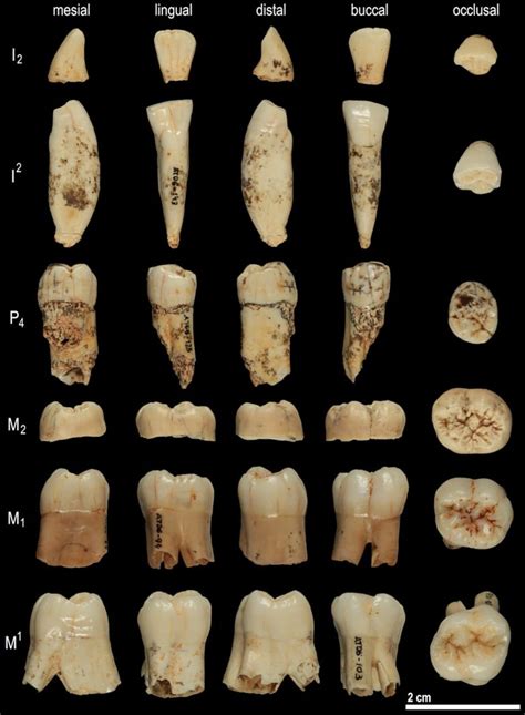 Fossil teeth yield oldest genetic material from extinct human species | CBC News