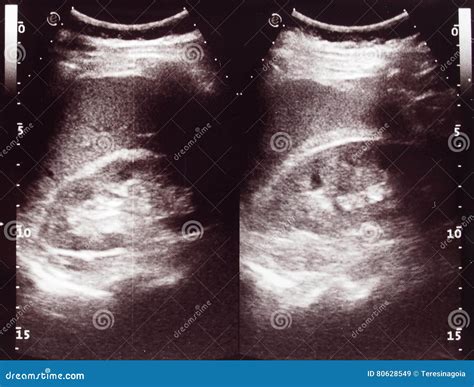 Diagnostic Sonography Of Abdomen Royalty-Free Stock Image ...