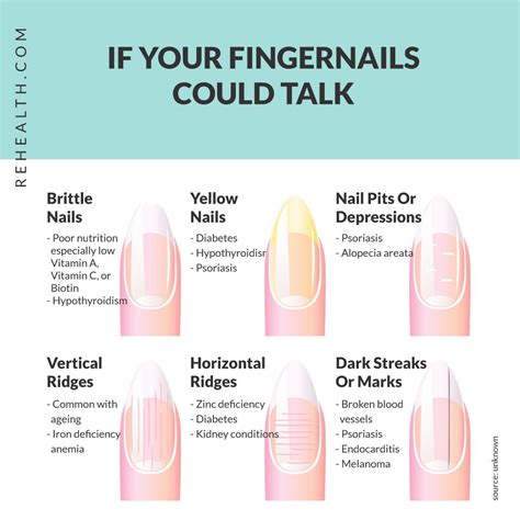 Vitamin Deficiency Fingernails Chart