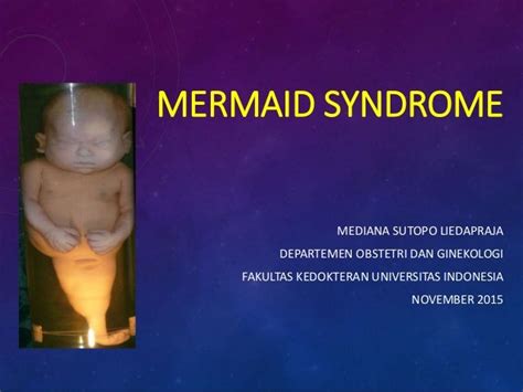 Mermaid syndrome. medi