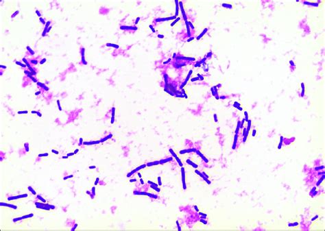 Gram Positive Cocci Blood Culture