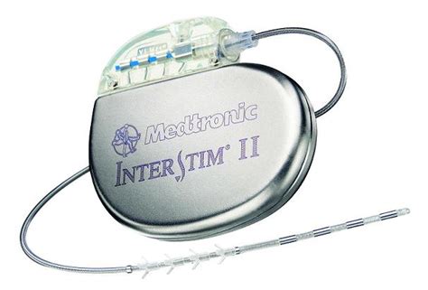 Sacral Neuromodulation