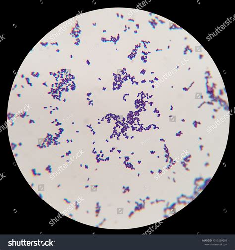 Bacteria Gram Staining Under Microscopic View Stock Photo 1319269289 | Shutterstock