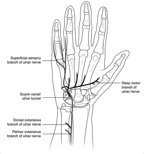 Ulnar Tunnel Syndrome, Radial Tunnel Syndrome, Anterior Inte... : JAAOS - Journal of the ...