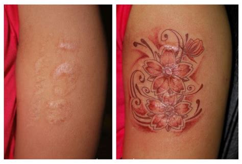 58 best tattoos for mastectomy scars images on Pinterest | Breast ...