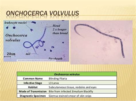 ONCHOCERCA VOLVULUS Onchocerca volvulus Common Name Blinding Filaria ...