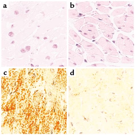 Light-microscopic examination of cardiac tissue from 18-day-old MHC-ACS... | Download Scientific ...