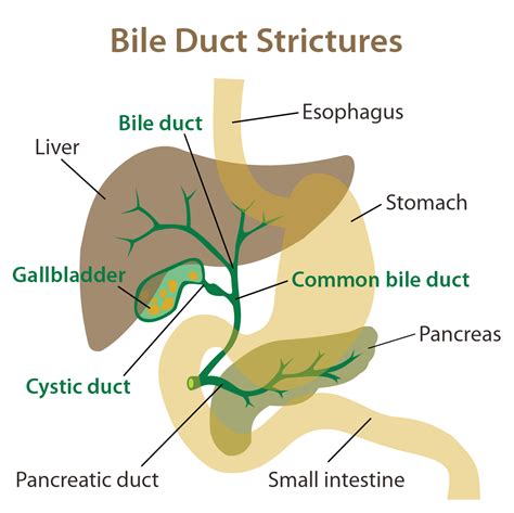 New American guidelines on how to deal with a blocked bile duct