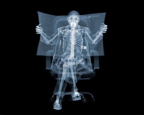 Beautiful X-Ray Photography (30 pics) - Izismile.com