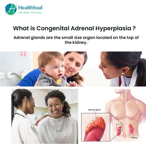 Congenital Adrenal Hyperplasia: Causes, Symptoms and Treatment – Healthsoul