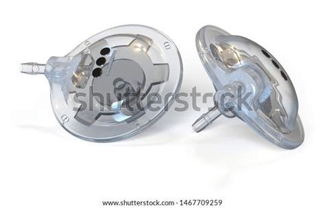 90 Medical Shunt Plastic Images, Stock Photos & Vectors | Shutterstock