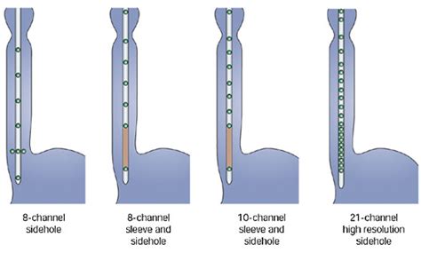 Esophageal Manometry Procedure