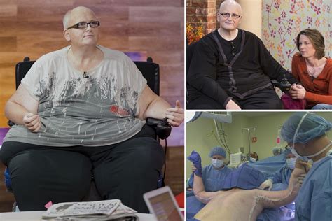 World’s fattest man begs NHS for £100k weight loss surgery after moving back to UK from America ...