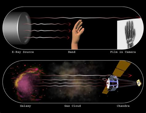 Chandra :: Resources :: X-Ray Astronomy vs. Medical X-Rays