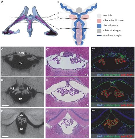 Frontiers | Morphology of the murine choroid plexus: Attachment regions ...