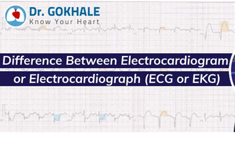 EKG Vs ECG What's The Difference Between ECG And EKG?, 42% OFF