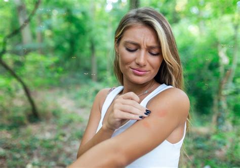 Spider Bite vs. Mosquito Bite: How To Tell the Difference | The Camping ...