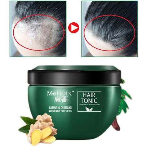 300g Hair Loss Treatment Cream Effective Men Women Hair Loss Treatment Hair Regrowth Treatment ...