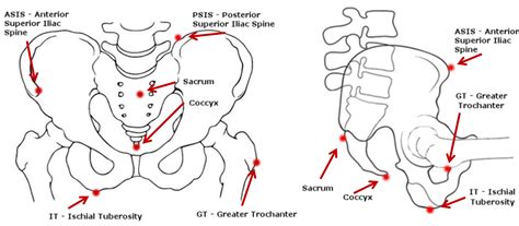 Bony Landmarks Of The Pelvis