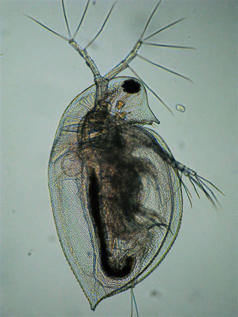 Pond life photomicrographs: Cladocera