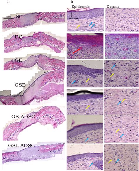 H&E staining. (a) H&E-stained transverse section of skin of various... | Download Scientific Diagram