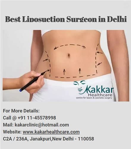 Best Liposuction Surgeon in Delhi Infogram | Dr. Vijay Kakka… | Flickr