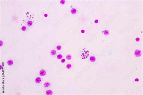 Chromosomes Human under the microscope for education. Stock Photo ...