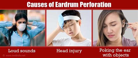 Causes, Symptoms and Signs of Eardrum Perforation