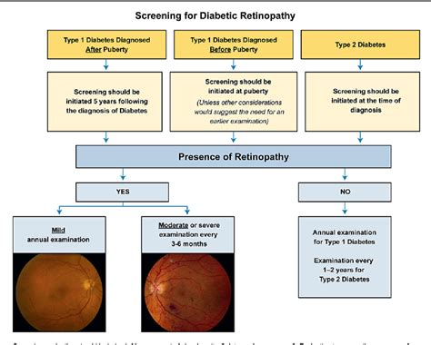 Treatment Of Proliferative Diabetic Retinopathy