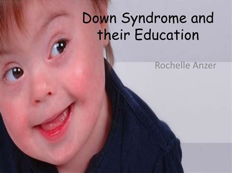 PPT - Down Syndrome and their Education PowerPoint Presentation, free ...