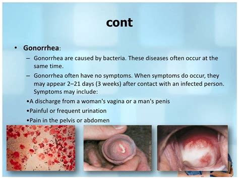 Different between syphilis & gonorrhea