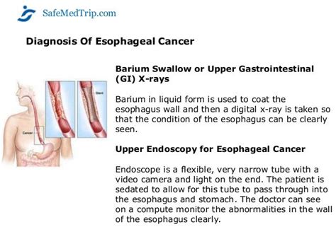 Esophageal Cancer Surgery at World Class Hospitals in India