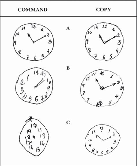 Figure 1 from Improvement Pattern in the Clock Drawing Test in Early ...