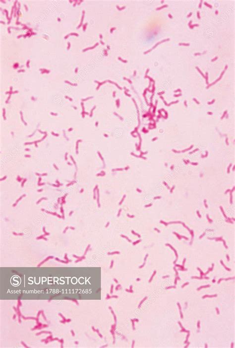 Vibrio cholerae, pathogenic enterobacteriaceae, seen under a microscope ...