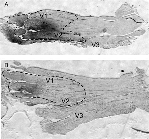 Sections of the trigeminal ganglion with the three divisions (V1–V3) of... | Download Scientific ...