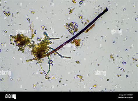 Fungal and fungi hyphae under the microscope in the soil and compost ...