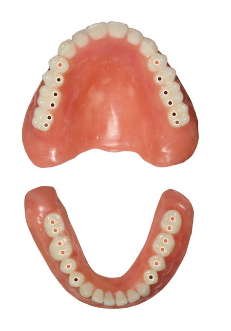 Utilizing Lingualized Posterior Occlusion – Mid-Continental Dental Supply