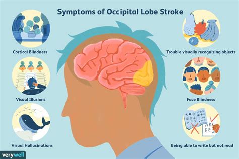 Best Brain Hemorrhage Hospital in India and Surgery Cost