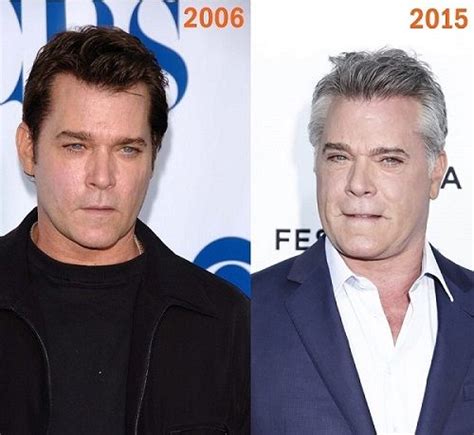 What Happened to Ray Liotta’s Face? | Plastic surgery, Ray liotta, Face