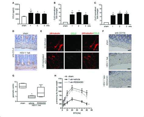 | CCL2 is required for macrophage recruitment and intestinal... | Download Scientific Diagram