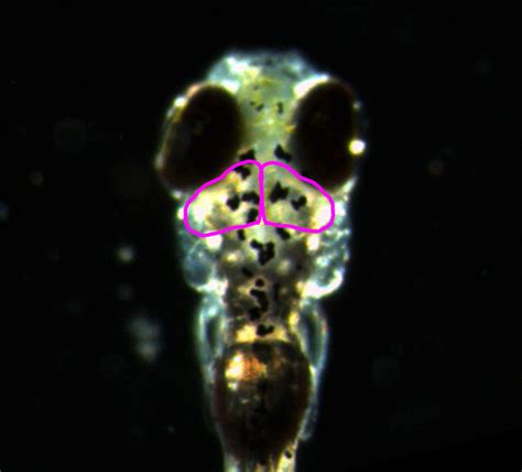 Real-time Observation of Neuronal Activity in a Zebrafish Larva | Yokogawa Europe