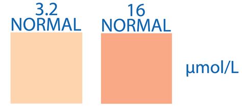 What is Urobilinogen in Urine?