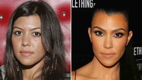 Kardashian-Jenner Sisters: Who Has Had The Most Plastic Surgery?