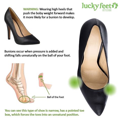 Check Out Our Tips to Help Treat Your Bunions at Home | Lucky Feet Shoes