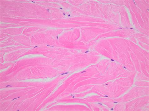 Histology Image Connective Tissue