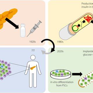 From purified insulin to β‐cell replacement therapy. Insulin therapy... | Download Scientific ...