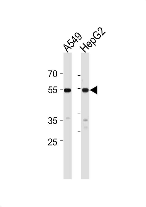 ALDH2 Antibody - Cat. No. 57-651 | ProSci