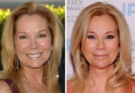 Kathie Lee Gifford Plastic Surgery Before And After Cosmetics | Plastic surgery, Kathie lee ...